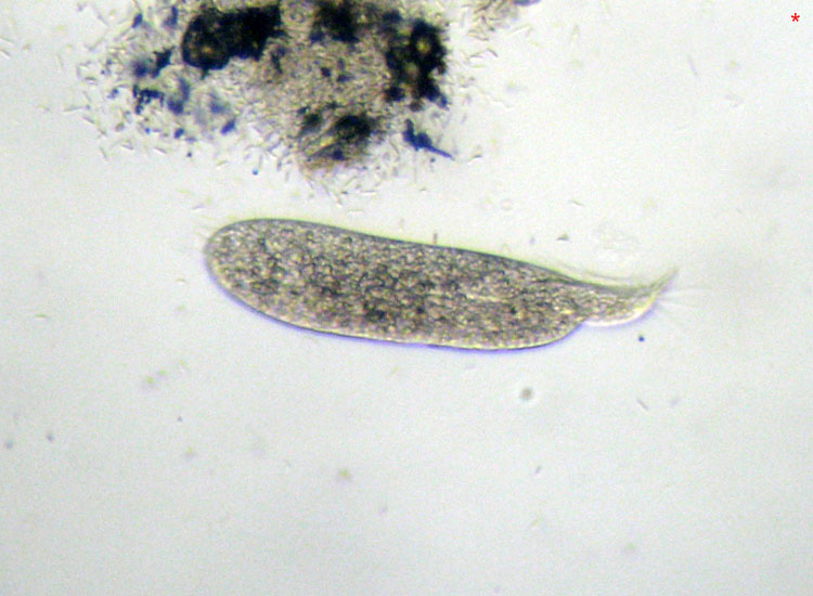 Protozoi marini: Trachelostyla pediculiformis ?